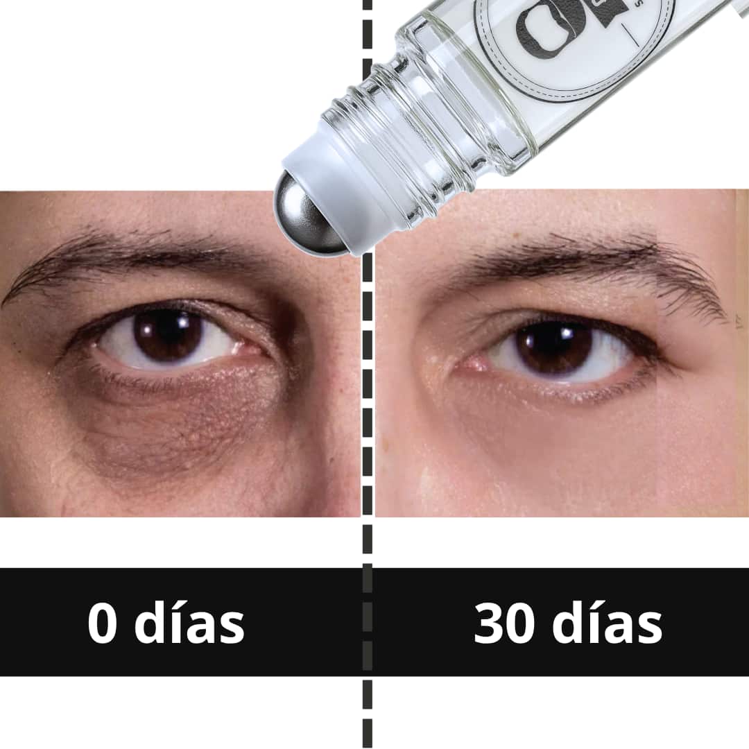 ROLL ON ANTI OJERAS 15ML EN CAJA