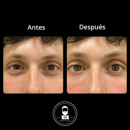ROLL ON ANTI OJERAS 15ML EN CAJA